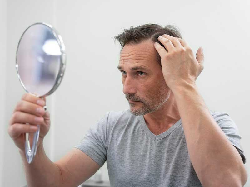 Man Worried About His Hair and Thinkng About Folicerin