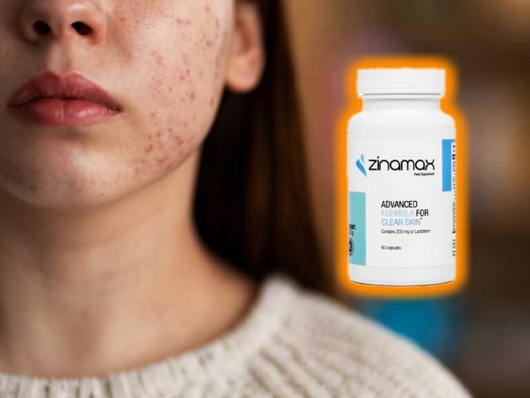 Does Zinamax Really Work on Female Face